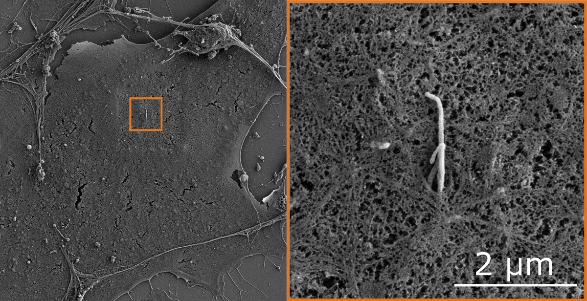 Primary cilium on the surface of mouse embryonic fibroblast (orange box left and zoom right) visualized using scanning electron microscopy. Scale bar, 2 µm. 